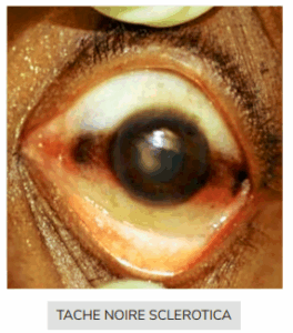 eyes-2