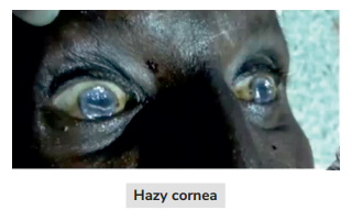 eyes